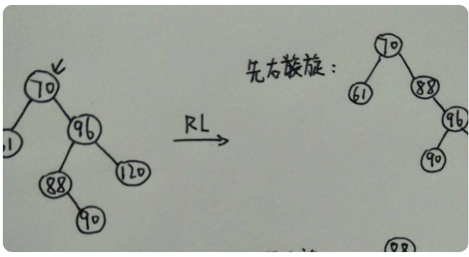 什么是平衡二叉樹(shù)